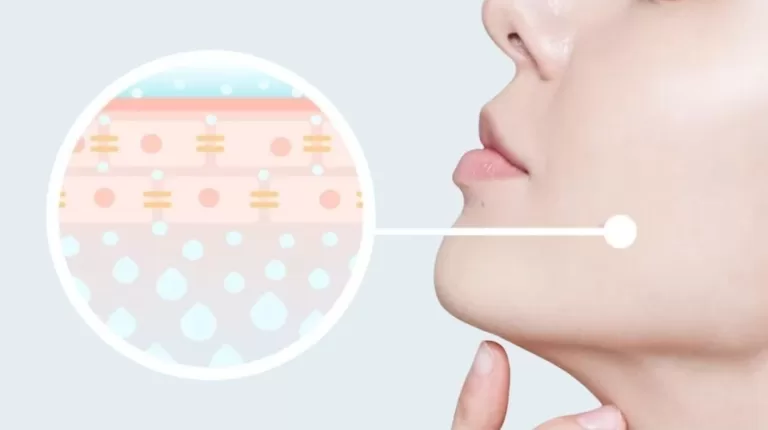 image of a diagram explaining corneotherapy alongside a woman's face