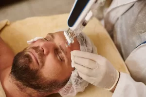 A man have Mesotherapy treatment on his forehead.